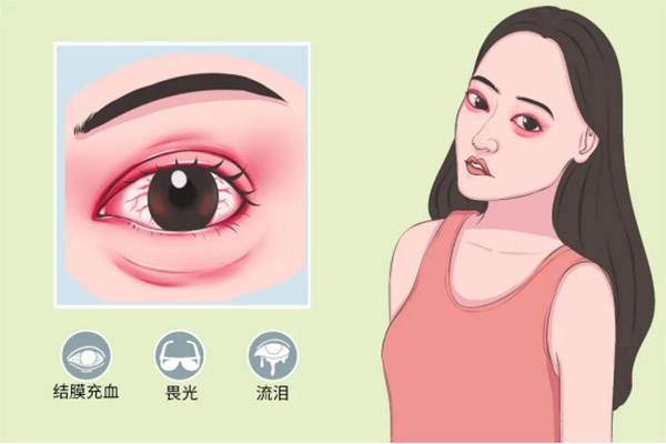 次氯酸治療細(xì)菌性和病毒性結(jié)膜炎