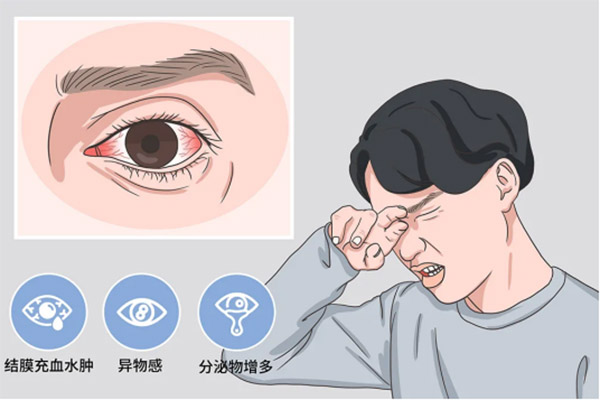 次氯酸治療細(xì)菌性和病毒性結(jié)膜炎