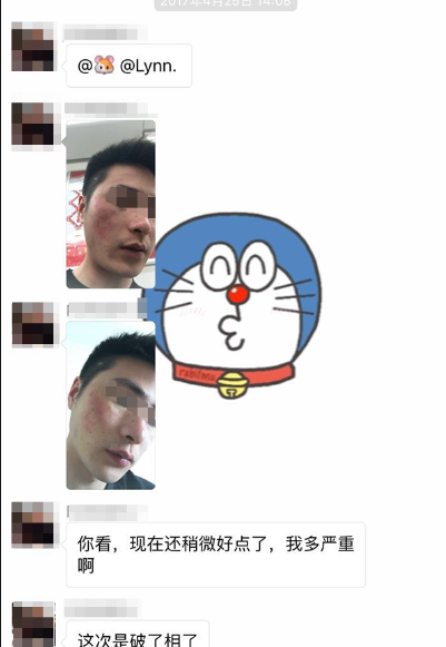 特應性皮炎苦不堪言