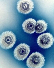 次氯酸水可有效去除霉菌