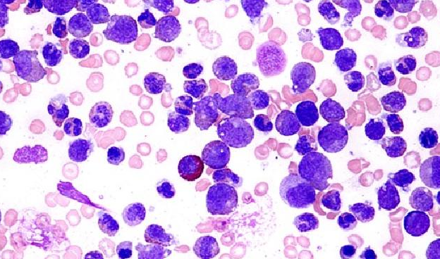 支原體交叉感染圖片